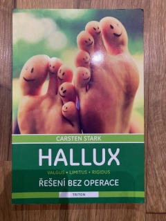 Hallux - Řešení bez operace